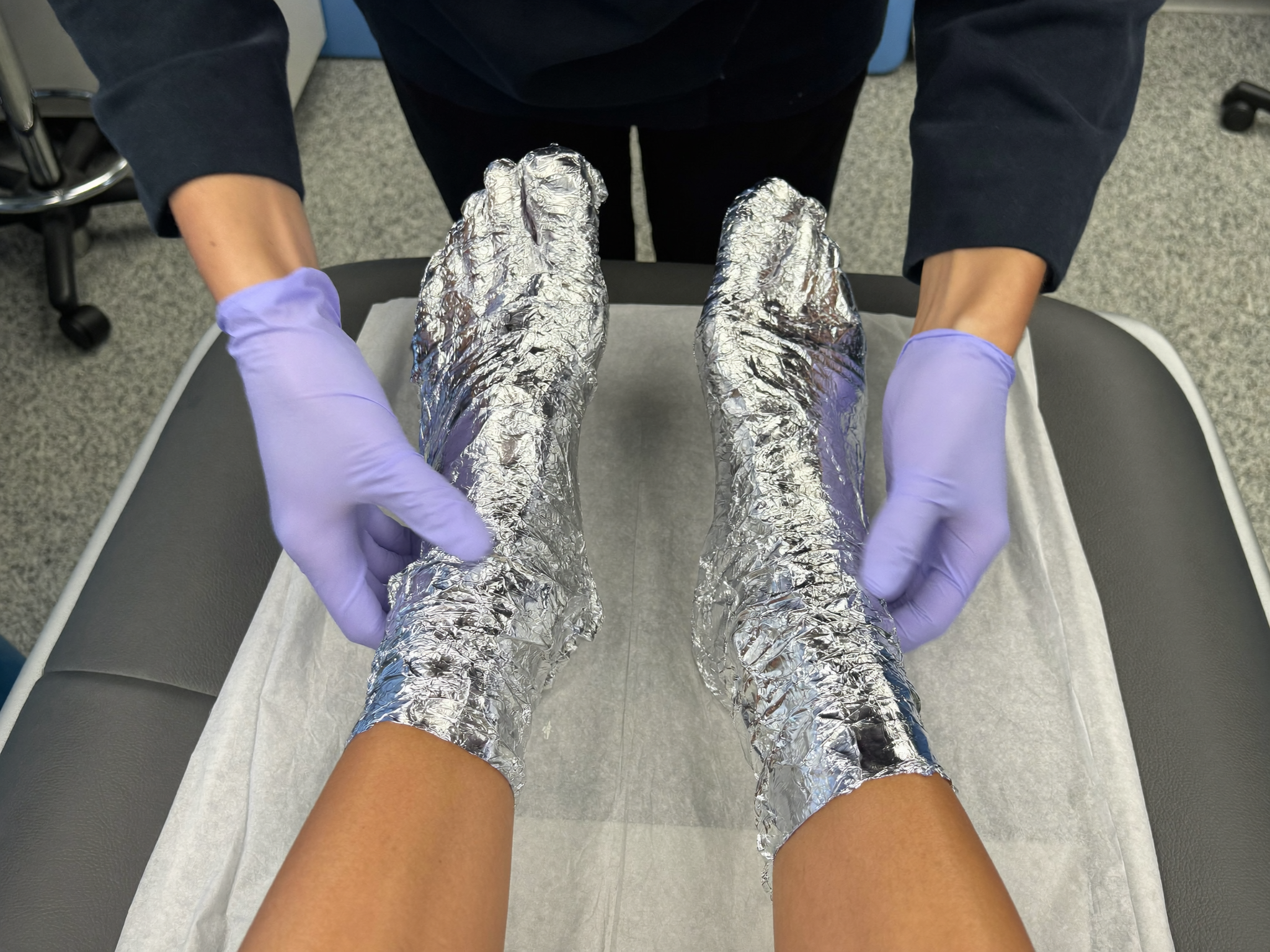 Traitement de pieds souffrant de douleurs nerveuses brûlantes