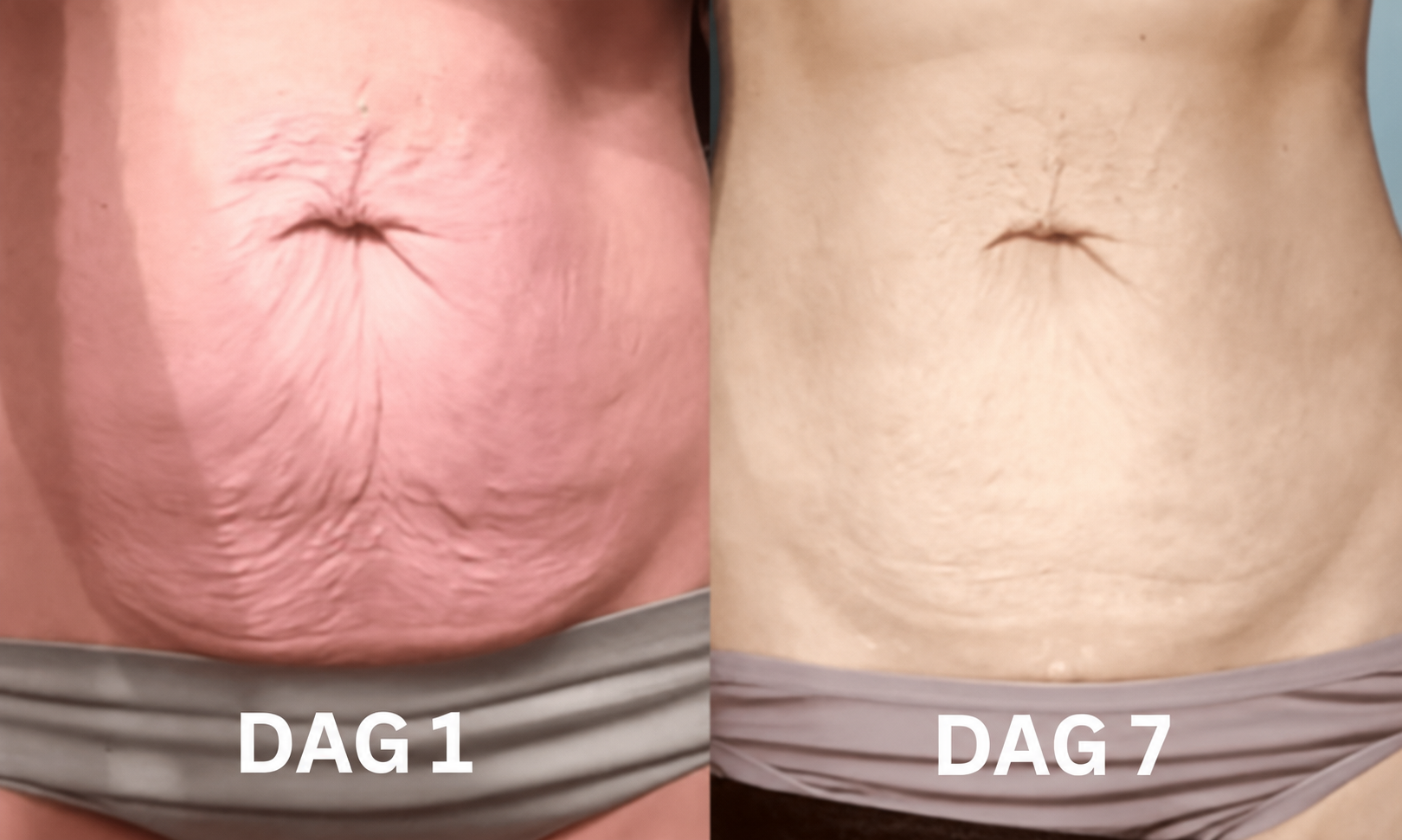 Dag 1 og dag 7 – mave