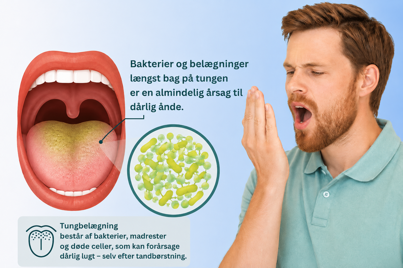 Belægninger og bakterier på tungen kan forårsage dårlig ånde