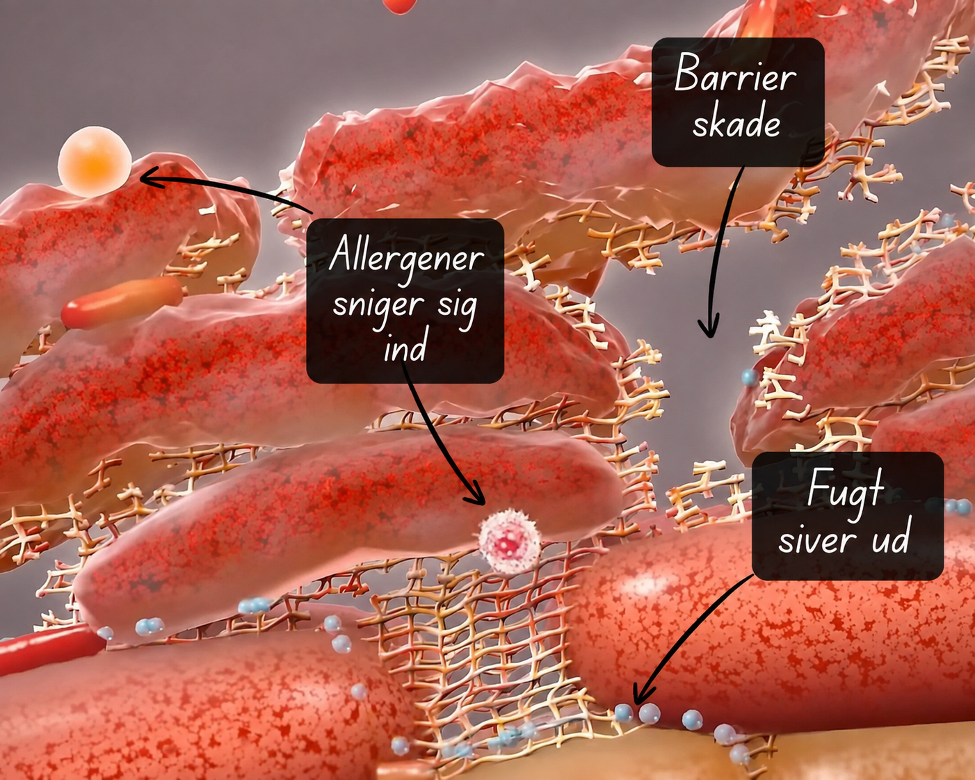 Diagram over beskadiget hudbarriere