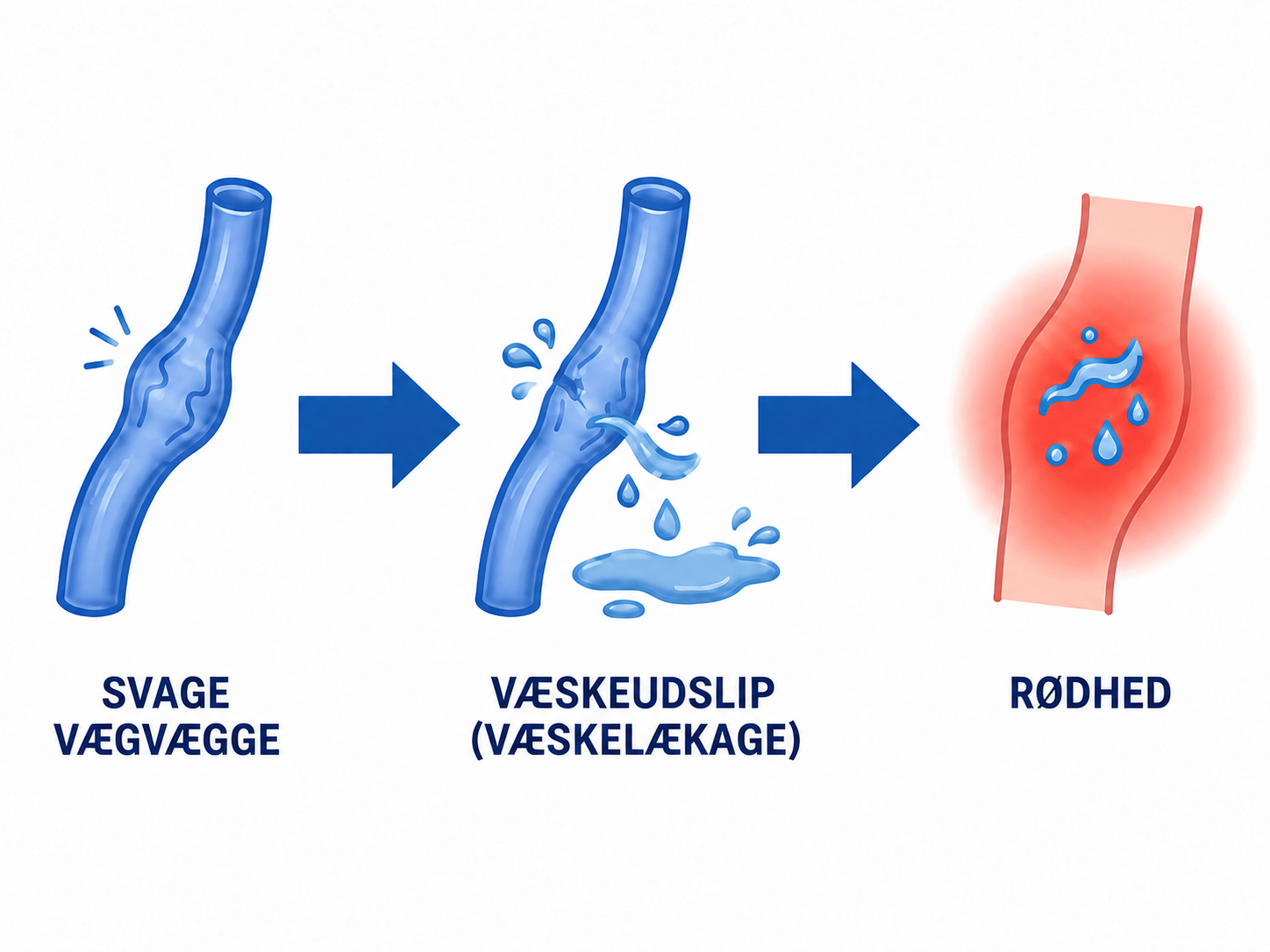 Diagram over svag venevæg, væskelækage og rødme