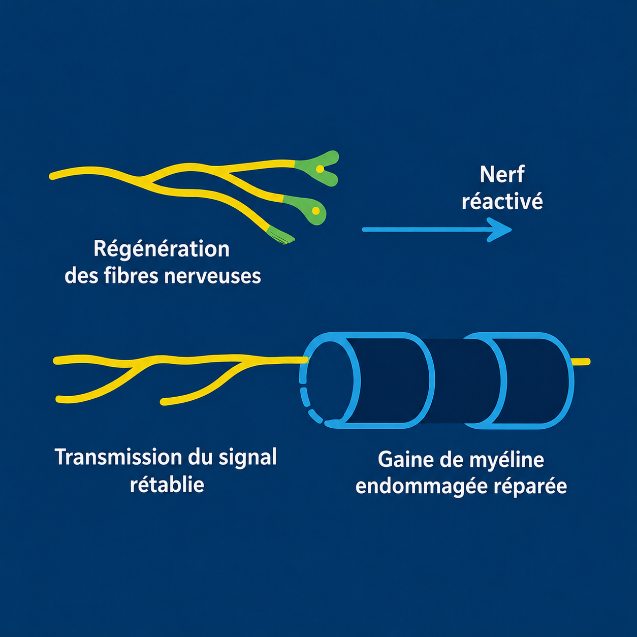 Illustration de la réparation des fibres nerveuses