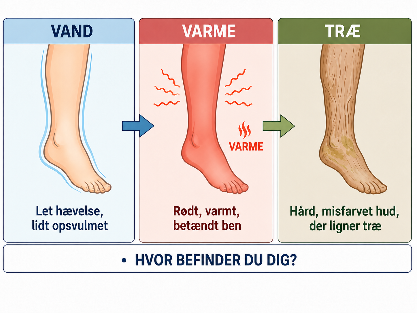 De tre faser af hævede og misfarvede ben