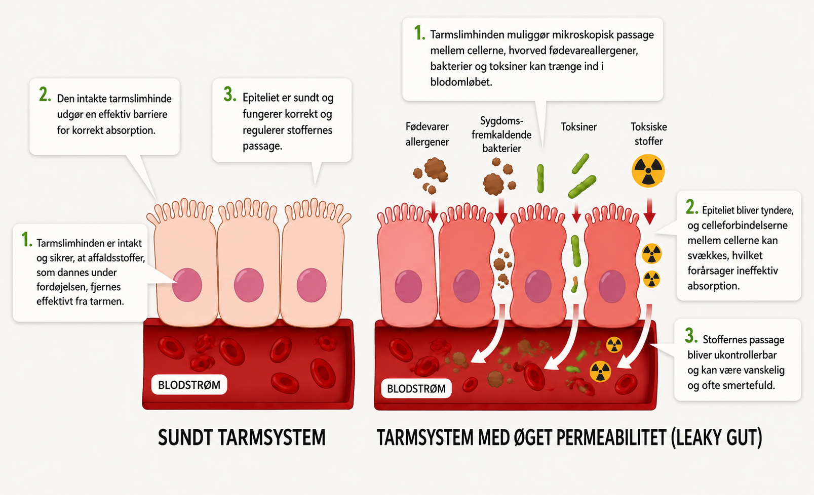 Sund tarm og utæt tarm